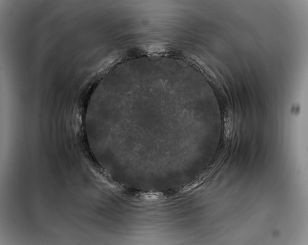 X0000099310618200805021315