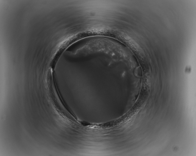 X0000099310640200805021315