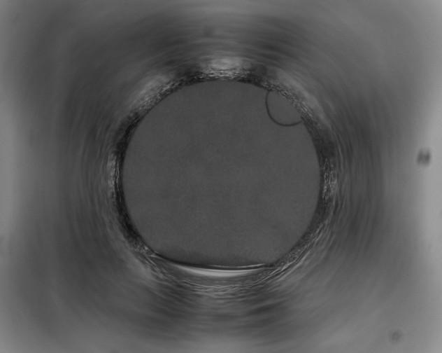 X0000099310647200805021315
