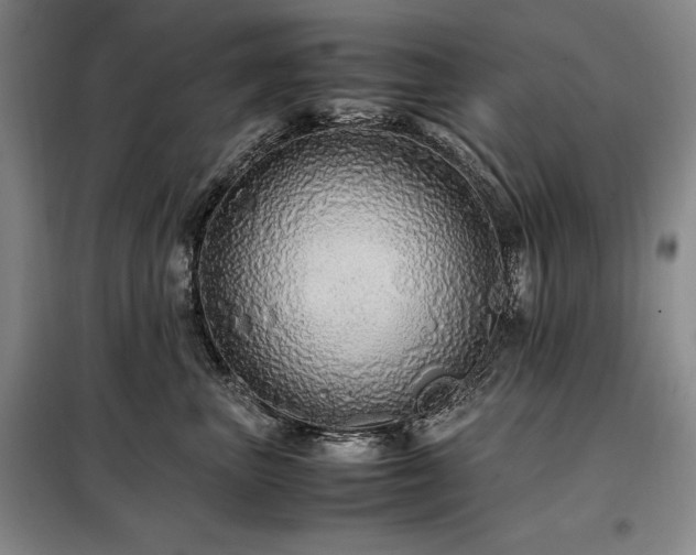 X0000099310667200805021315