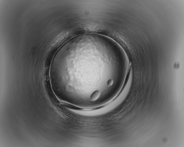 X0000099310738200805021314