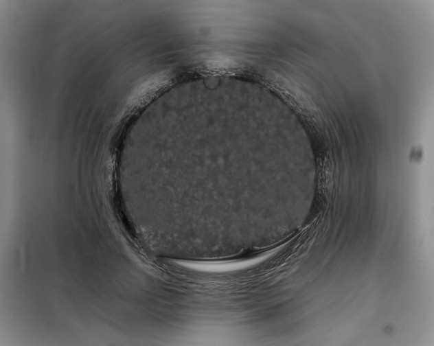 X0000099310742200805021314