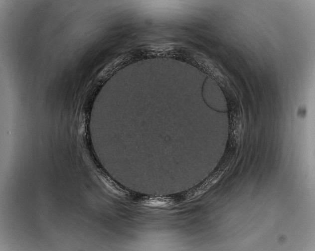 X0000099310758200805021314