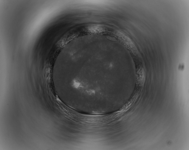 X0000099310762200805021314