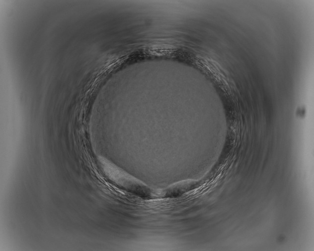 X0000099310817200805021312