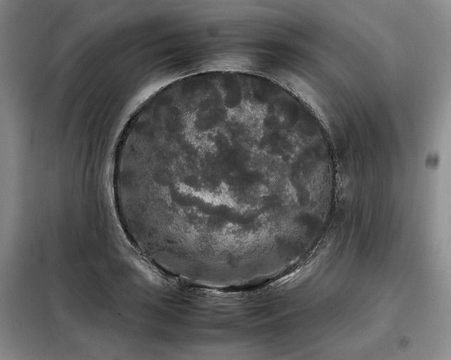 X0000099311035200805021309