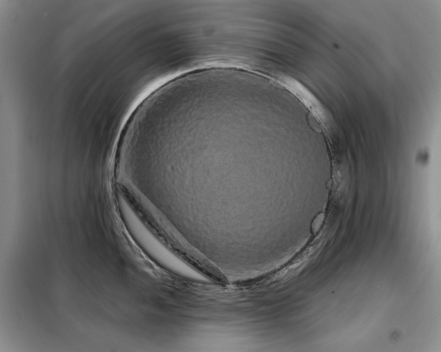 X0000099311052200805021310