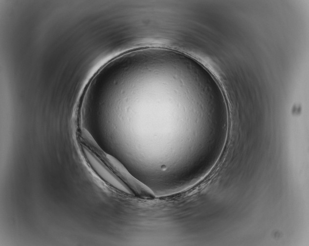 X0000099311056200805021310