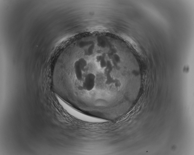 X0000099311063200805021309