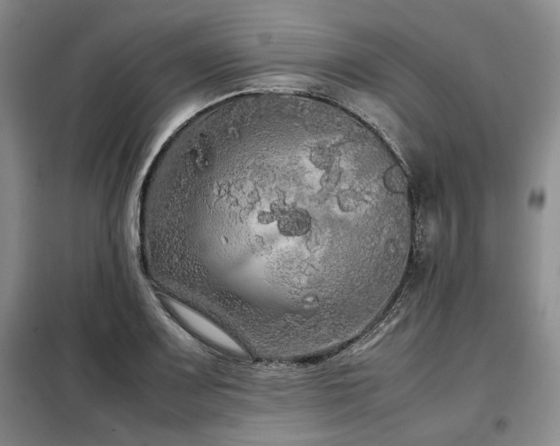 X0000099311083200805021308