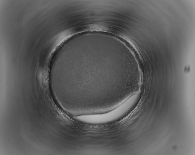 X0000099311115200805021307