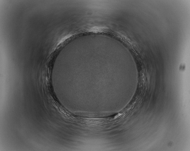 X0000099311158200805021307