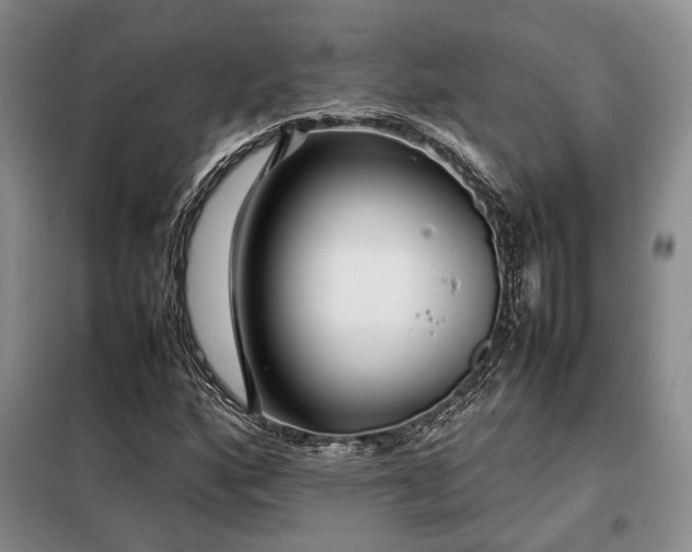 X0000099311160200805021307