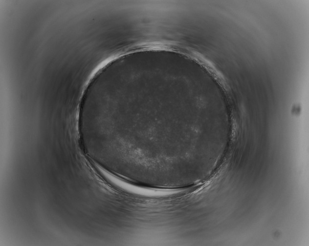X0000099311174200805021307