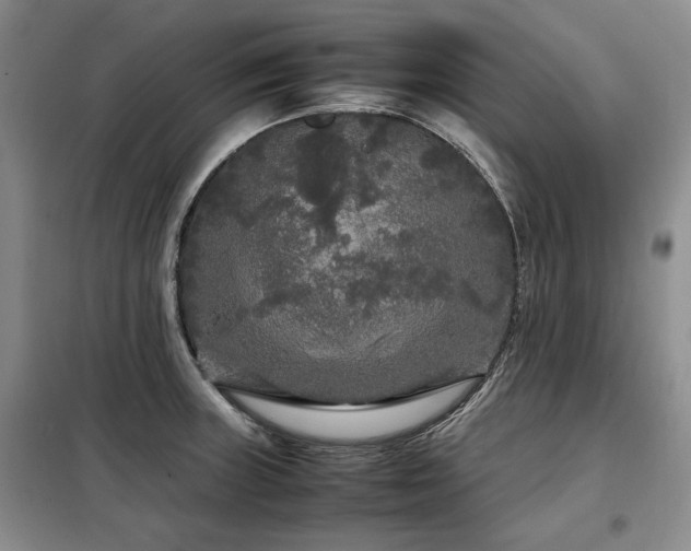 X0000099311235200805021306