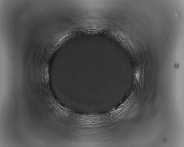 X0000099311252200805021306