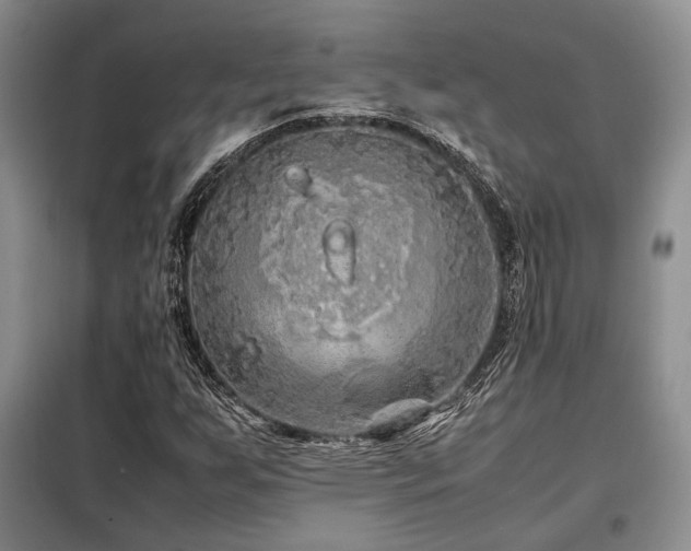 X0000099311255200805021306
