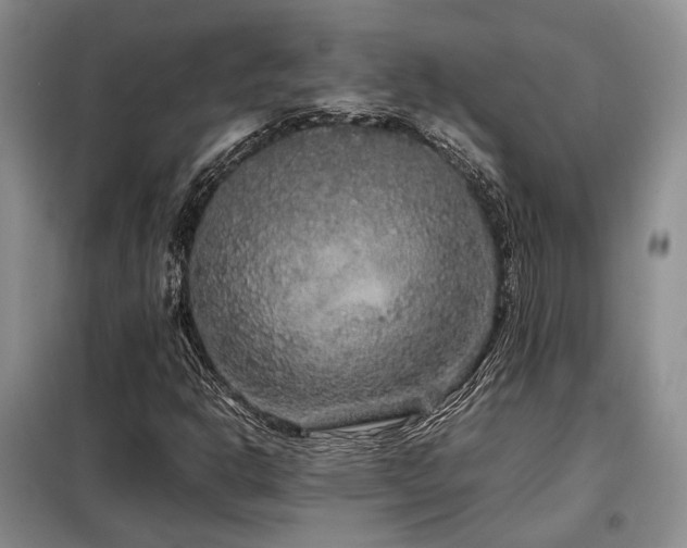X0000099311302200805021305