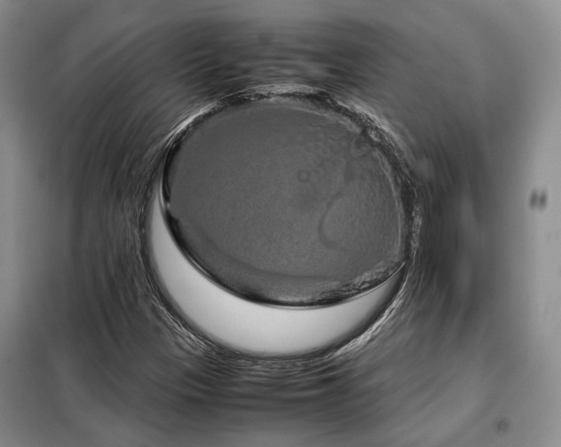 X0000099311305200805021305