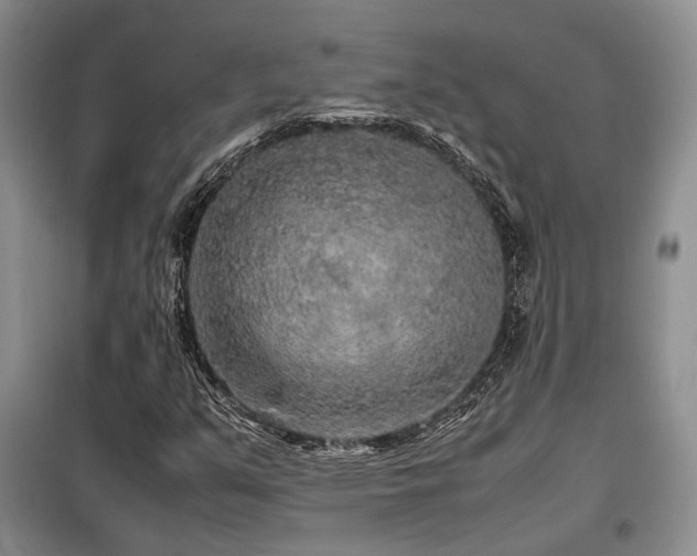 X0000099311351200805021304