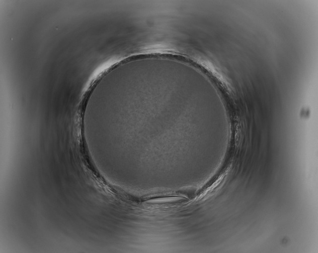 X0000099311358200805021304