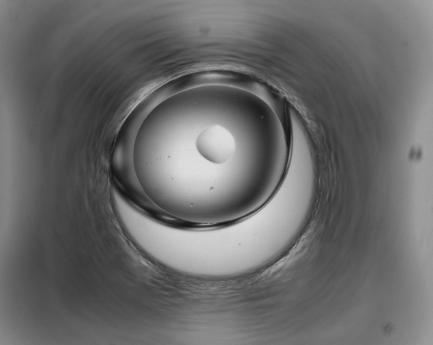 X0000099311369200805021304