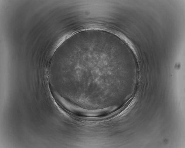 X0000099311385200805021304