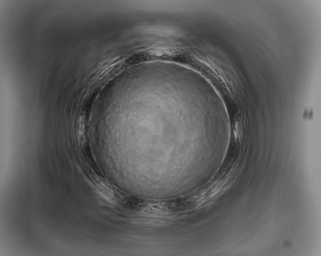 X0000099311396200805021303