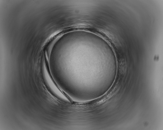 X0000099311402200805021303