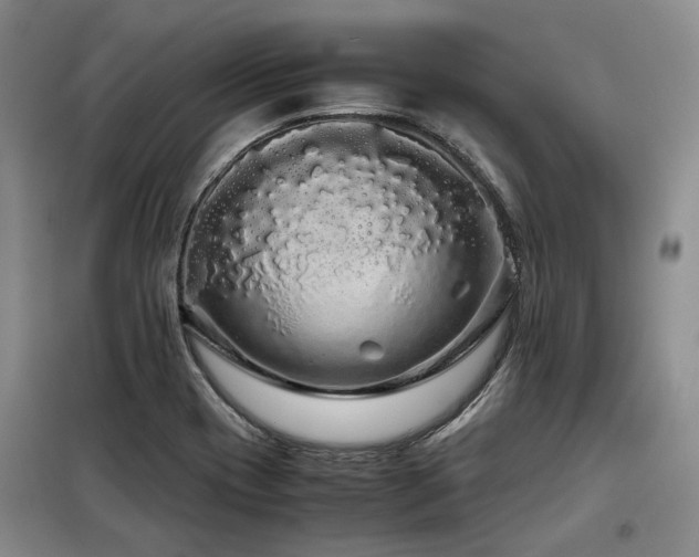 X0000099311417200805021303