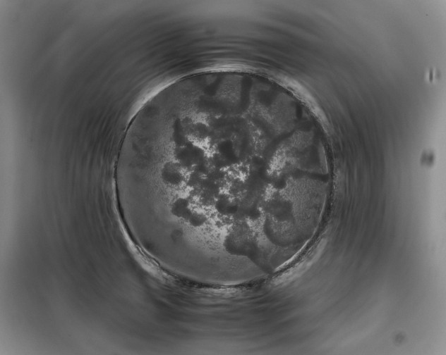 X0000099311425200805021303