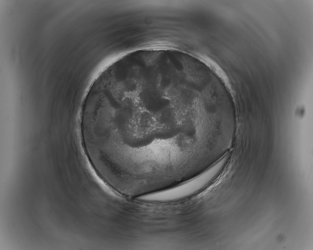 X0000099311429200805021304