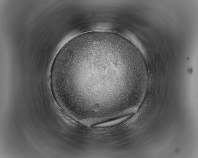 X0000099311435200805021304