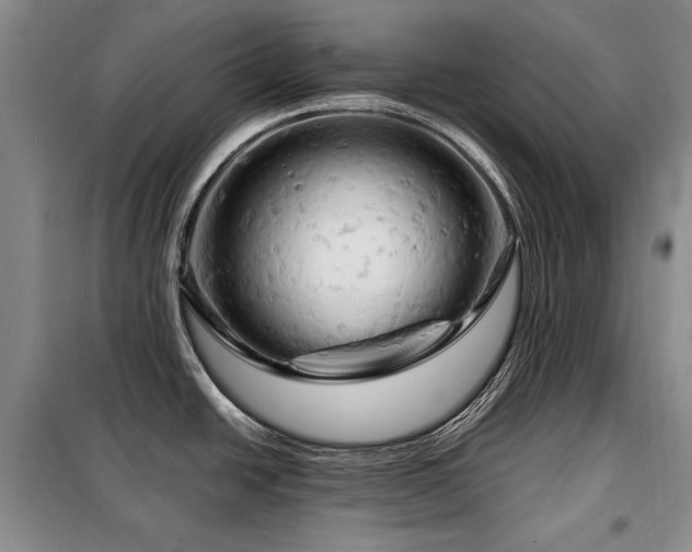 X0000099311438200805021304