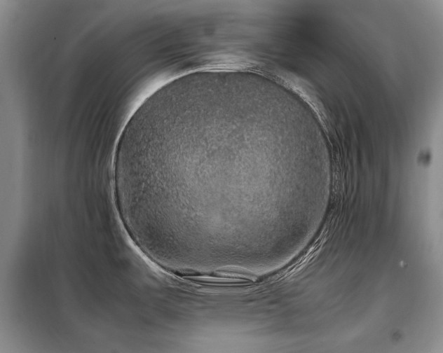X0000099311487200805021302