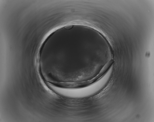 X0000099311515200805021302