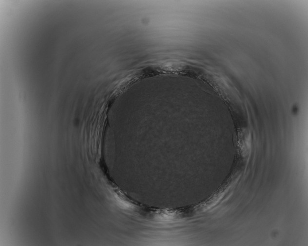 X0000099310235200805091025