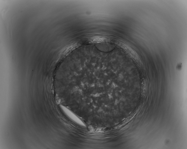 X0000099310361200805091023