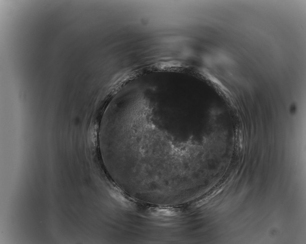 X0000099310475200805091022