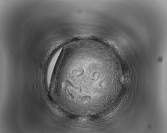 X0000099310495200805091021