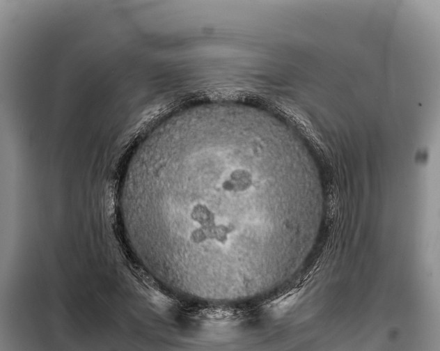 X0000099310687200805091018