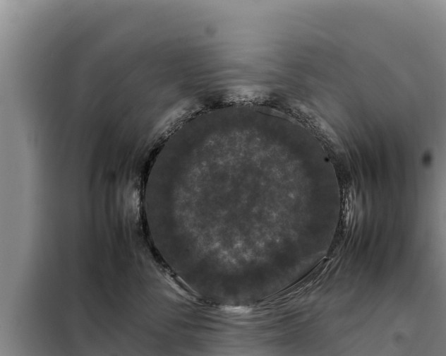 X0000099310716200805091017