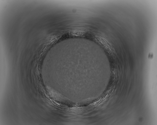 X0000099310817200805091015