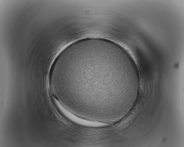 X0000099310887200805091015