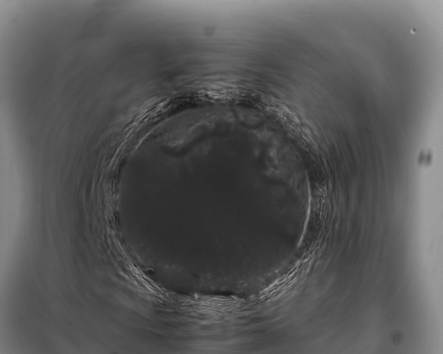 X0000099311009200805091013