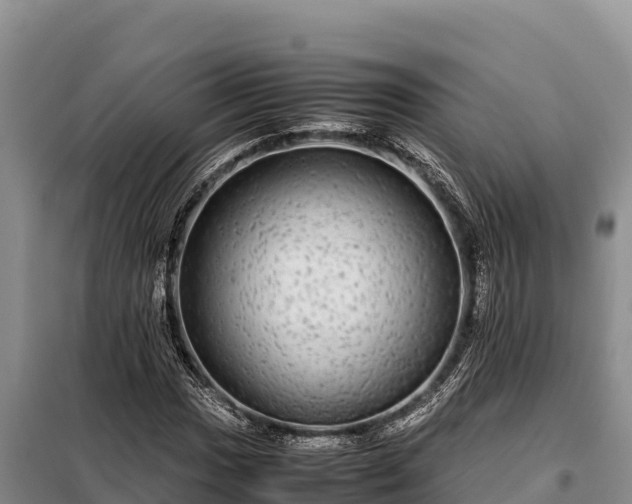 X0000099311017200805091013