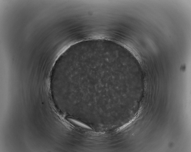 X0000099311023200805091013