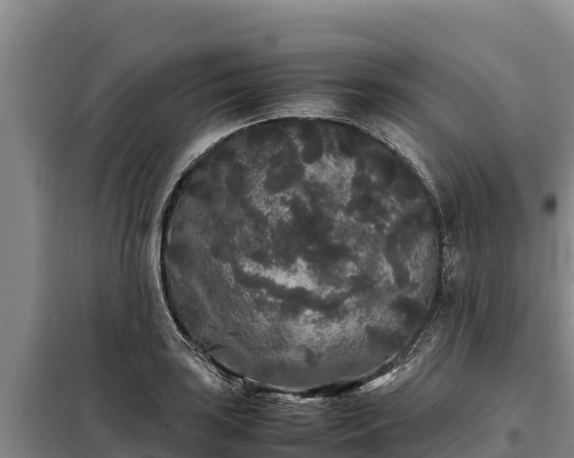 X0000099311035200805091013