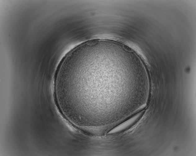 X0000099311040200805091013