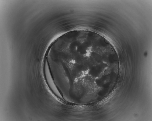 X0000099311045200805091013
